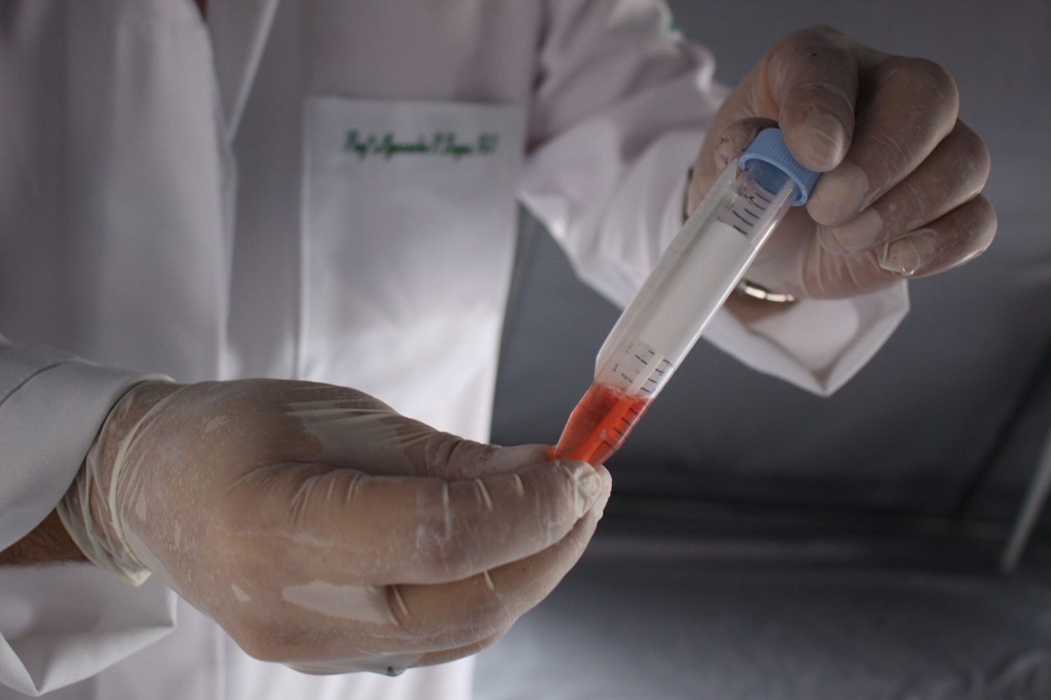 Os testes foram realizados pela Força-Tarefa Covid-19 da UFS nos dias 21 e 22 de janeiro