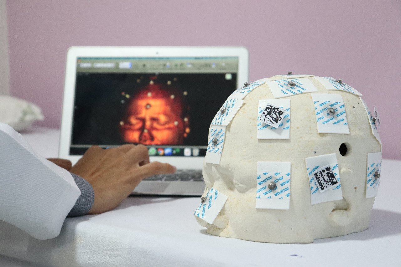 Tecnologia aumenta precisão de cirurgias neurológicas. Fotos: Josafá Neto/Rádio UFS