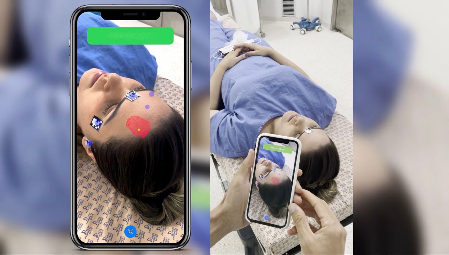 Foto: Reprodução/Neurokeipoint